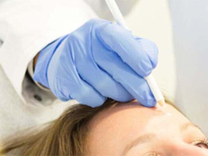 cosmetische-behandeling
